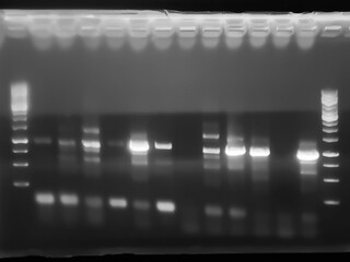 result of agarose gel electrophoresis of PCR products. separation of DNA fragments amplified with the PCR is used for genotyping of transgenic lines in search for heterozygeous lines with tDNA insert