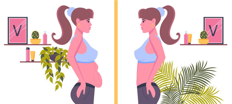 Overweight. Reducing fat in the abdominal area. Woman's body before and after weight loss, diet, fitness or liposuction.