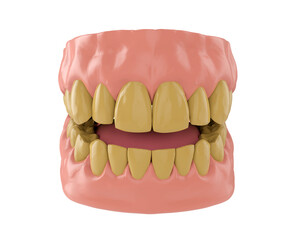 human Jaw with yellow teeth, 3d render