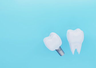 Tooth Crown and Tooth Implant on blue background with copy space, artificial tooth, 3d render