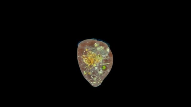 Infusoria Stentor under the microscope, the family Stentoridae, class Ciliata, feed on small organic residues, bacteria, algae, protozoa.In the stomach you can see the shells of Rotifera Keratella