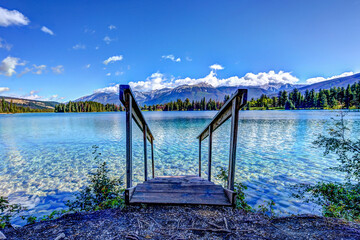 Landscapes of Lake Beauvert in Jasper