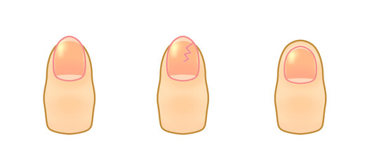 シンプルな爪_セット