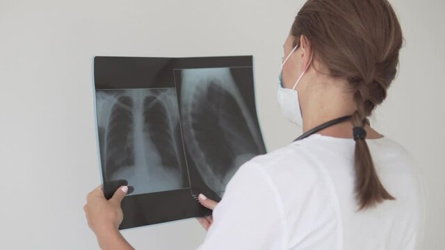 Female doctor examines X-ray of lungs affected by covid-19, view from back