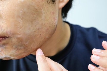 Naklejka premium 髭剃り後にスキンケアをする男性のクローズアップ