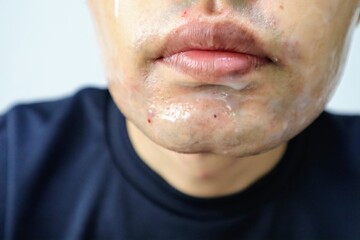 髭剃り後にスキンケアをする男性のクローズアップ