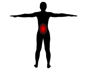 Rückansicht Frau mit Symbol für Schmerzen in der Lendenwirbelsäule