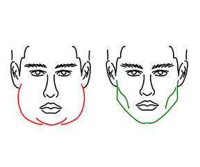 Silhouette of a male face on a white background. Correction of the lower jaw. Vector illustration. © alina_polina