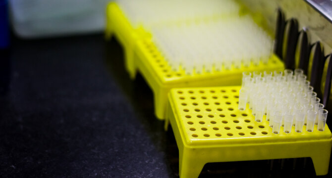 micro tips arranged and staked in a yellow micro tip stand for micro pipettes