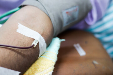 selective focus of blood collection during blood donation and ball in palm for squeezing