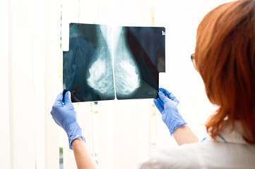 Fototapeta na wymiar The doctor looks at the x-ray of the female mammary glands