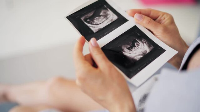 Beautiful pregnant woman wife holding ultrasound baby picture in her hand. Pregnancy woman and maternity healthcare concept.