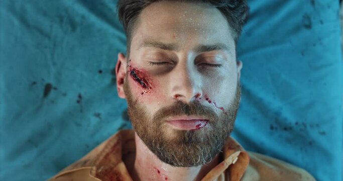Close up view of bearded man with blood and head traumas losing consciousness. Man in 40s with serious injuries lying on hospital stretcher while going in ambulance