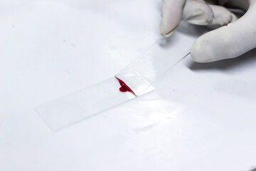 glass slide smear drawing of blood by glass slide