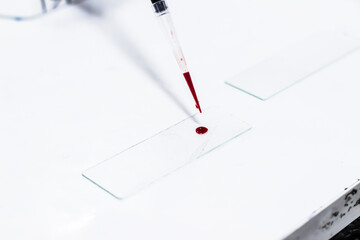 drop of blood on a glass slide using micropipette microtip