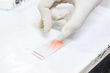 smear drawing of blood by glass slide
