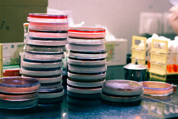 culture media plates stacked vertically on top of each other for colony analysis in a medical...