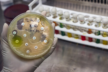 Top view of Culture plate of bacterial growth showing antibiotic sensitivity in their colony pattern placed geld in gloved hand