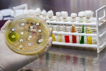 Side view of Culture plate of bacterial growth showing antibiotic sensitivity in their colony pattern placed geld in gloved hand