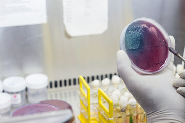 Inoculation on blood agar on a culture plate using inoculation loop by scientist inside fume hood...