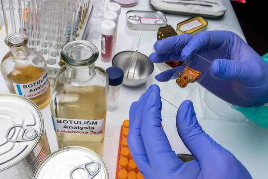 Experienced laboratory scientist analyzing a sample from a canned food can, botulism infection in sick people, conceptual image