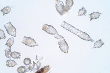 Tintinnid, any protozoan of the ciliate order Tintinnida, characteristically conical or trumpet-shaped.