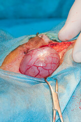 Bladder before the cut. Surgery for tumor removal.