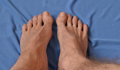 naked male legs on a blue towel.