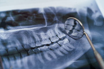 Dental instruments and jaw x-ray on white background. Panoramic jaw x-ray on white background....