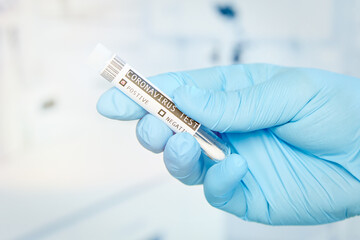 Obraz premium Hand with medical glove holding positive coronavirus covid-19 test swab in vial