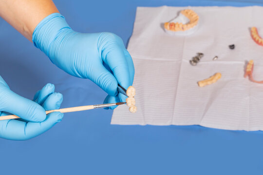 medical equipment. Making a denture. The doctor holds a crown in his hands and covers it with a special compound.