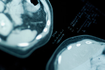Close-up of the MRI scan of the human brain