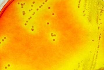Close-up of bacteria in a Petri dish