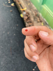 Accident wounded male finger with blood.