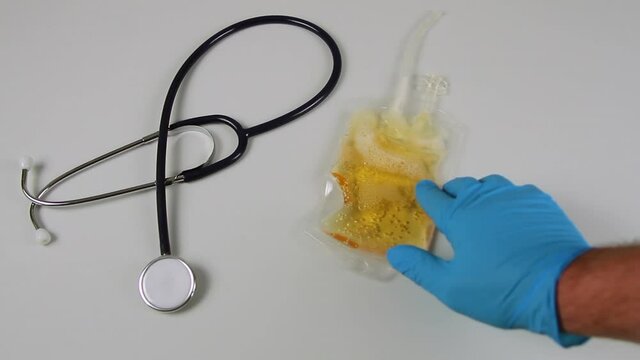 hand of a doctor in blue glove placing a catheter drainage bag containing urine on a hospital table next to a stethoscope