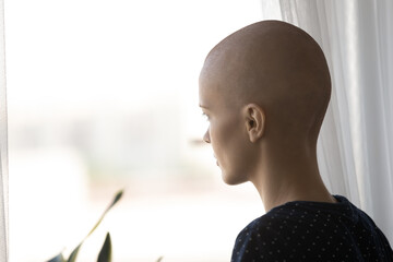 Back view of sad pensive hairless sick young woman struggle with oncology look in window lack...
