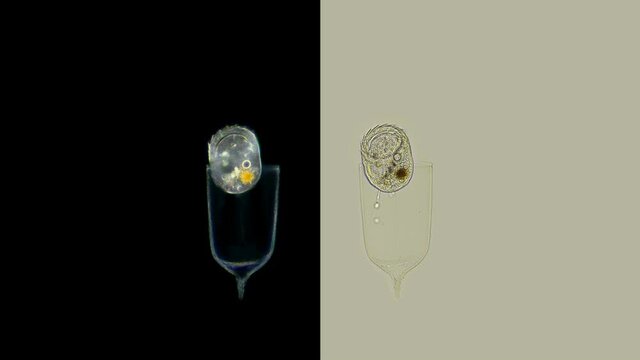 ciliates Tintinnida Favella sp. under the microscope, suborder Tintinnoinea, a distinctive feature of a shell in the form of a vase or bell. Samples found in the Black sea