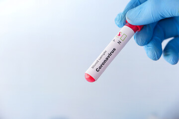 Naklejka premium laboratory technician hand holding blood test tube 
