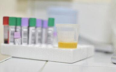 Medical report and urine test strips.