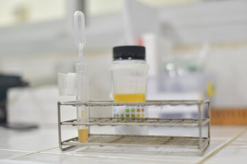 Medical report and urine test strips.