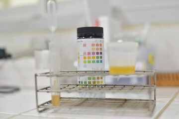 Medical report and urine test strips.