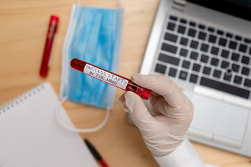 Handwriting text writing Success Starts In The Mind. Conceptual photo set your mind to positivity it can go a long way Extracted blood sample vial with lastest technology ready for examination