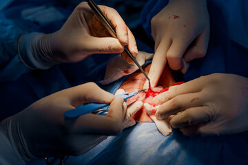 Close-up blepharoplasty lipofilling plastic surgery operation for modifying the eye region of the face in medical clinic. 2 doctors do plastic cosmetic operation for woman. Surgeon sutures the eyelid