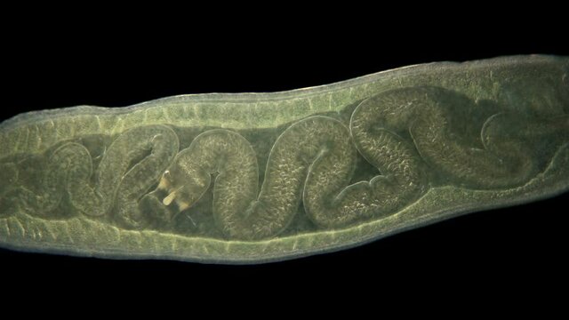 Worm Tetrastemma sp. under the microscope, Nemertea Phylum, vast majority of predators, also scavengers. Work of internal organs is visible. Black Sea