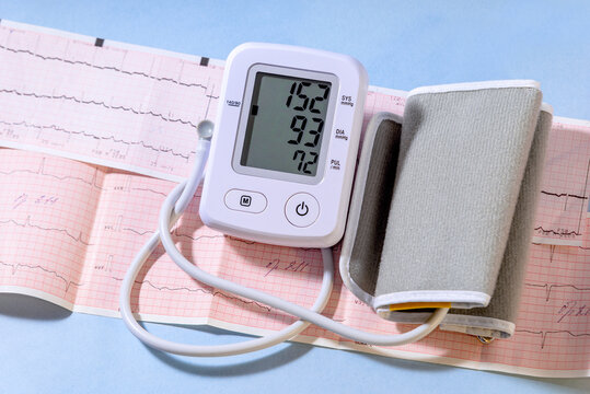 White Electric Tonometer On A Cardiogram And High Pressure Value. Medicine Concept.