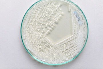 Yeast in petri dish, Microbiology for education in laboratories.
