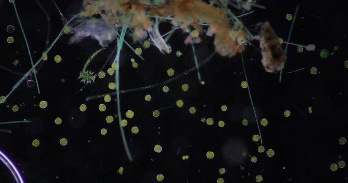 Glenodinium sp.under the microscope for education.
