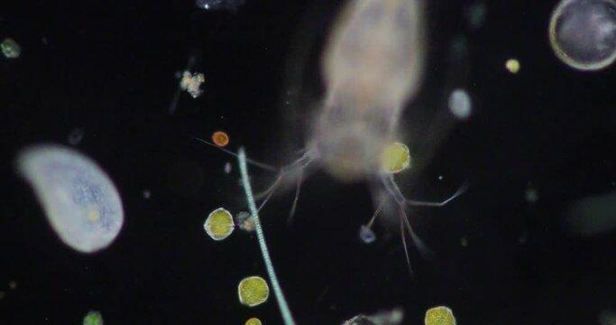 Glenodinium sp.under the microscope for education.
