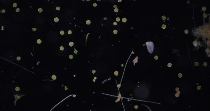 Glenodinium sp.under the microscope for education.
