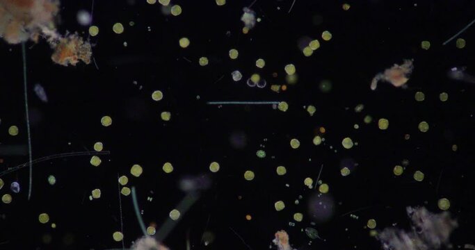 Glenodinium sp.under the microscope for education.
